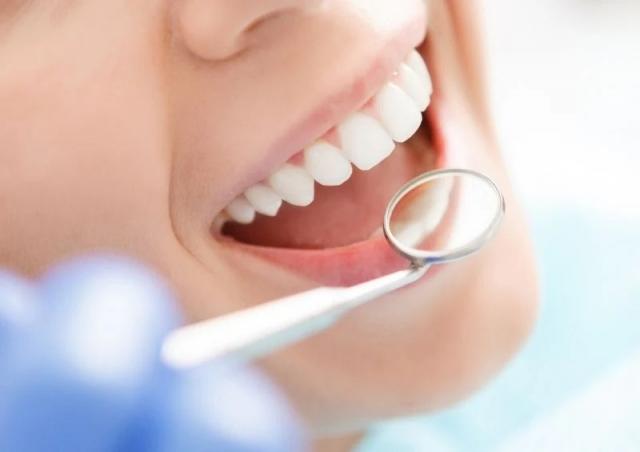 Smile Makeover Guide: How to Achieve Your Dream Smile