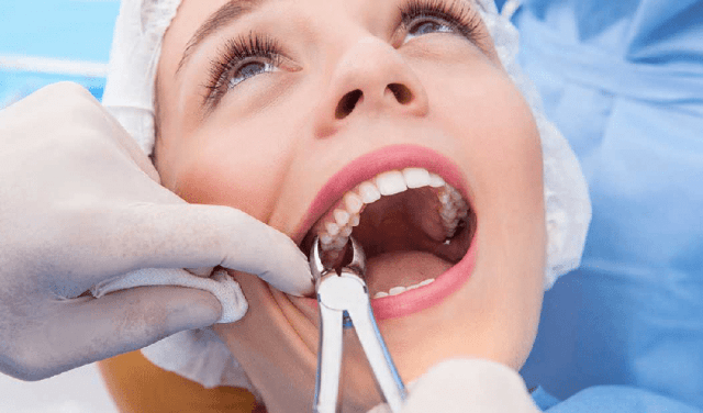 How Long After Having a Tooth Pulled Can You Smoke?